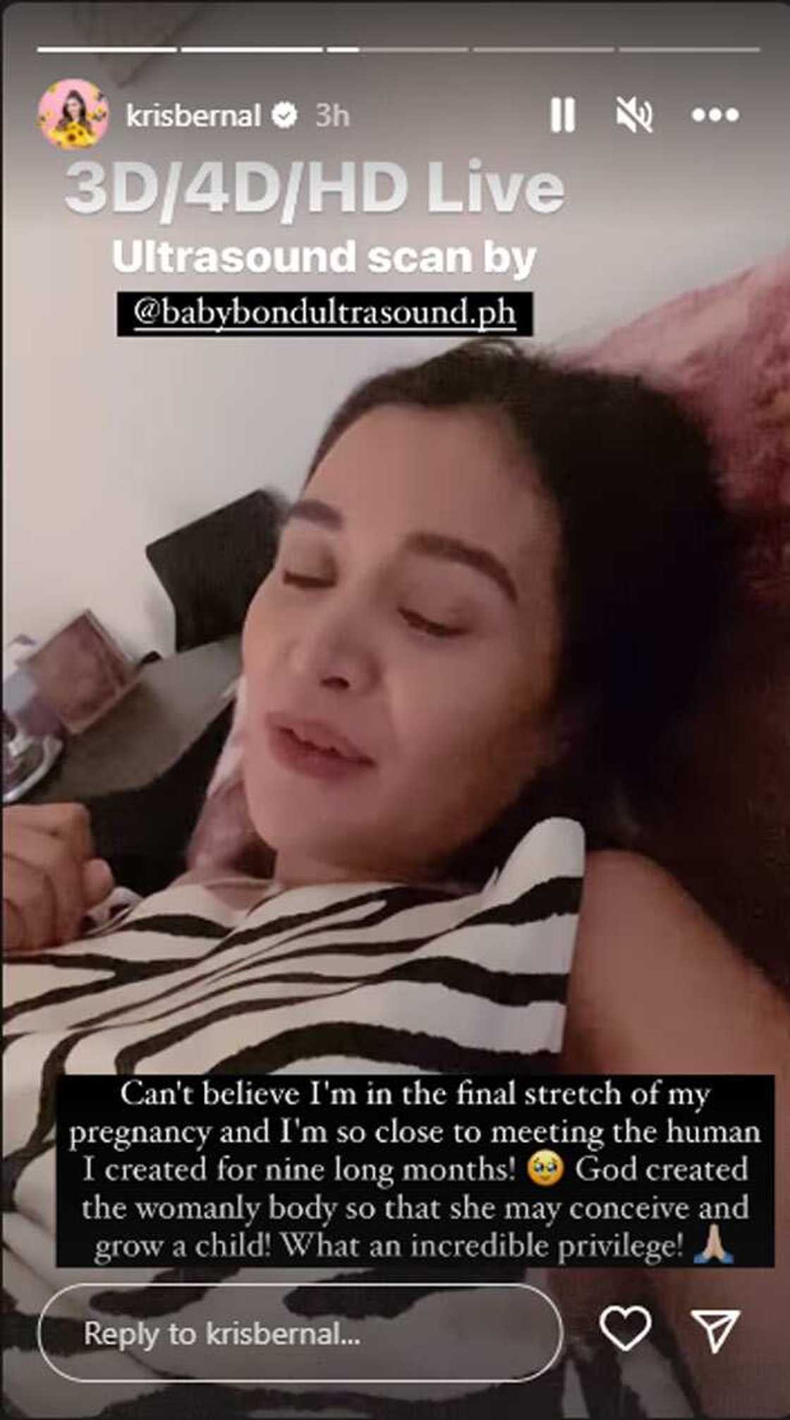 Kris Bernal Kris Bernal