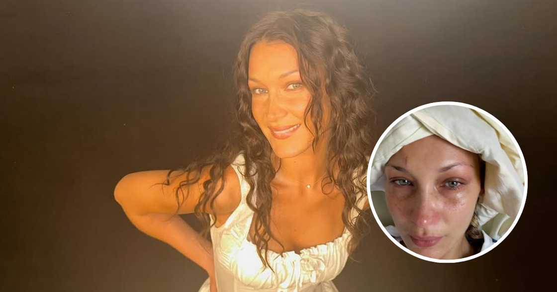 Bella Hadid, muling isinugod sa ospital dahil sa Lyme disease Bella Hadid, muling isinugod sa ospital dahil sa Lyme disease