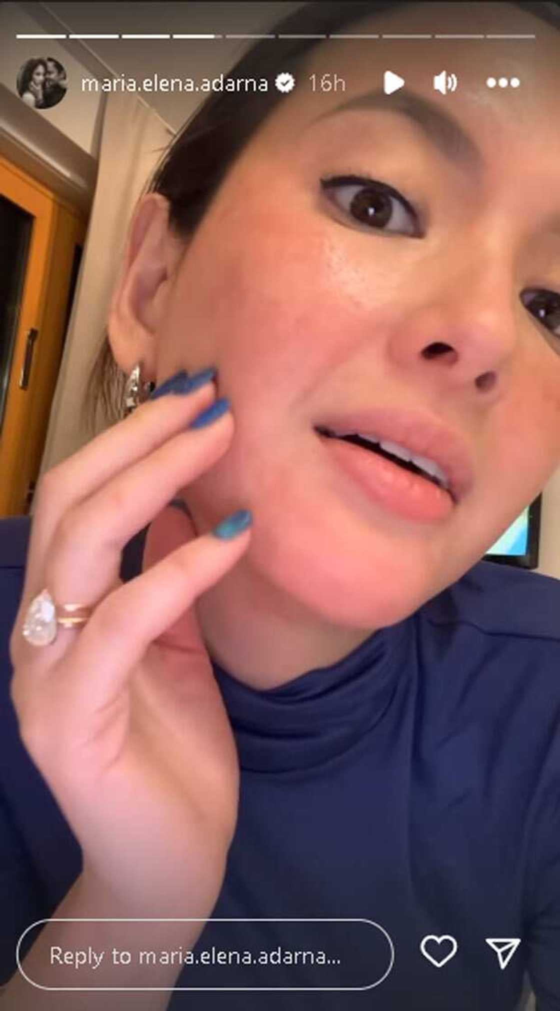 Ellen Adarna Ellen Adarna