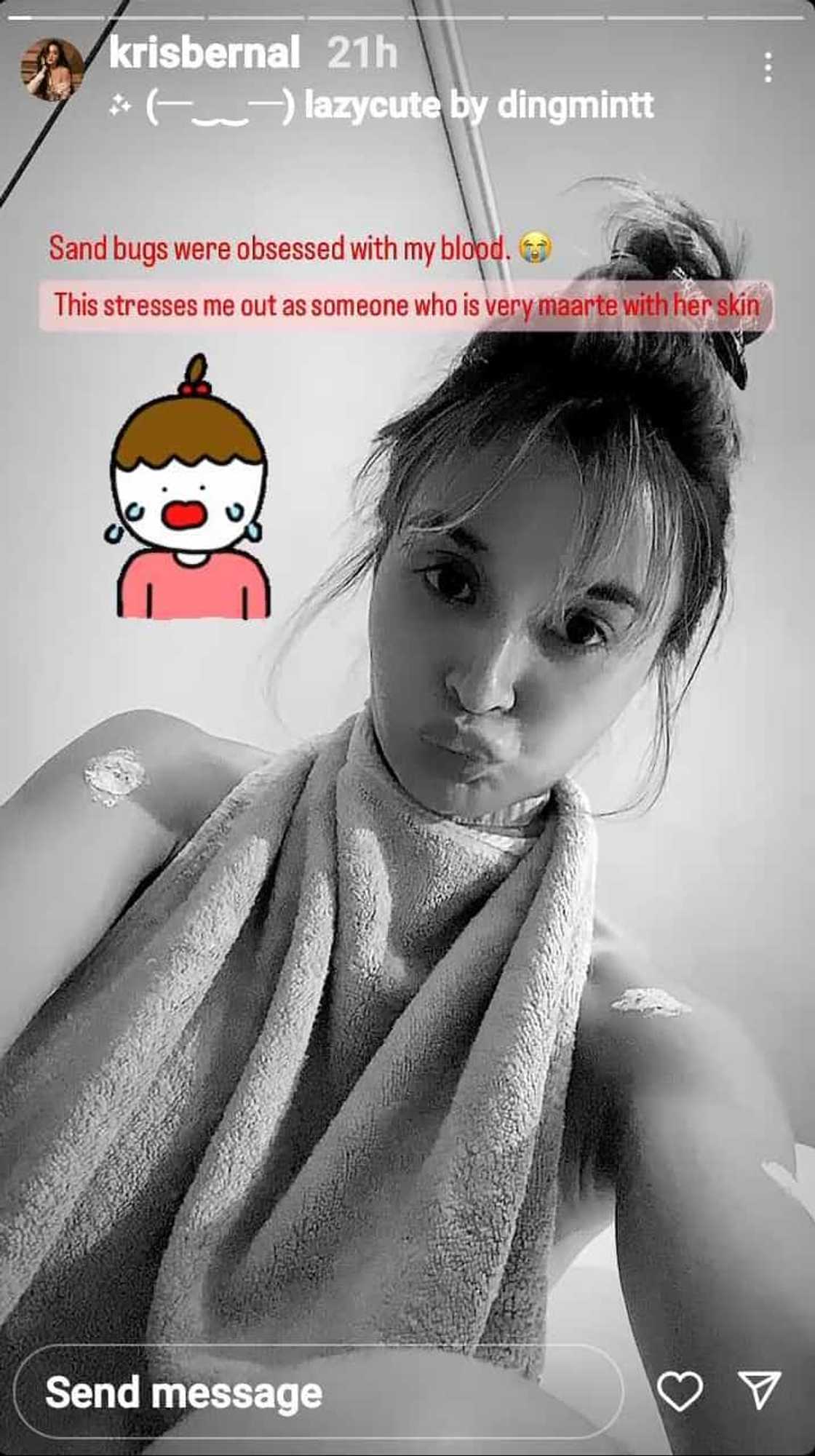 Kris Bernal, labis na na-stress nang napuno ng niknik bites ang katawan Kris Bernal, labis na na-stress nang napuno ng niknik bites ang katawan