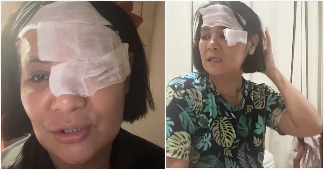 Candy Pangilinan, kinailangang mag-isolate dahil tinamaan siya ng shingles Candy Pangilinan, kinailangang mag-isolate dahil tinamaan siya ng shingles