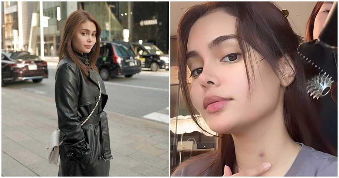 Ivana Alawi, may nakakatawang paliwanag ukol sa pasa niya sa leeg Ivana Alawi, may nakakatawang paliwanag ukol sa pasa niya sa leeg