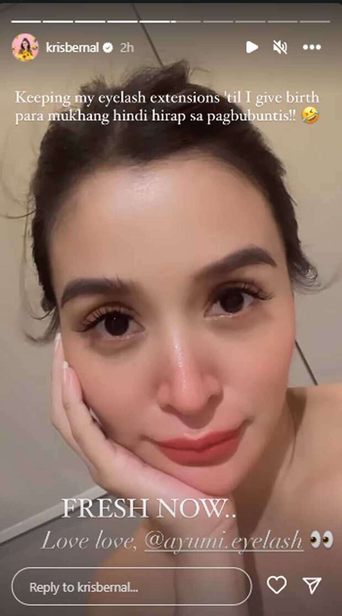 Kris Bernal