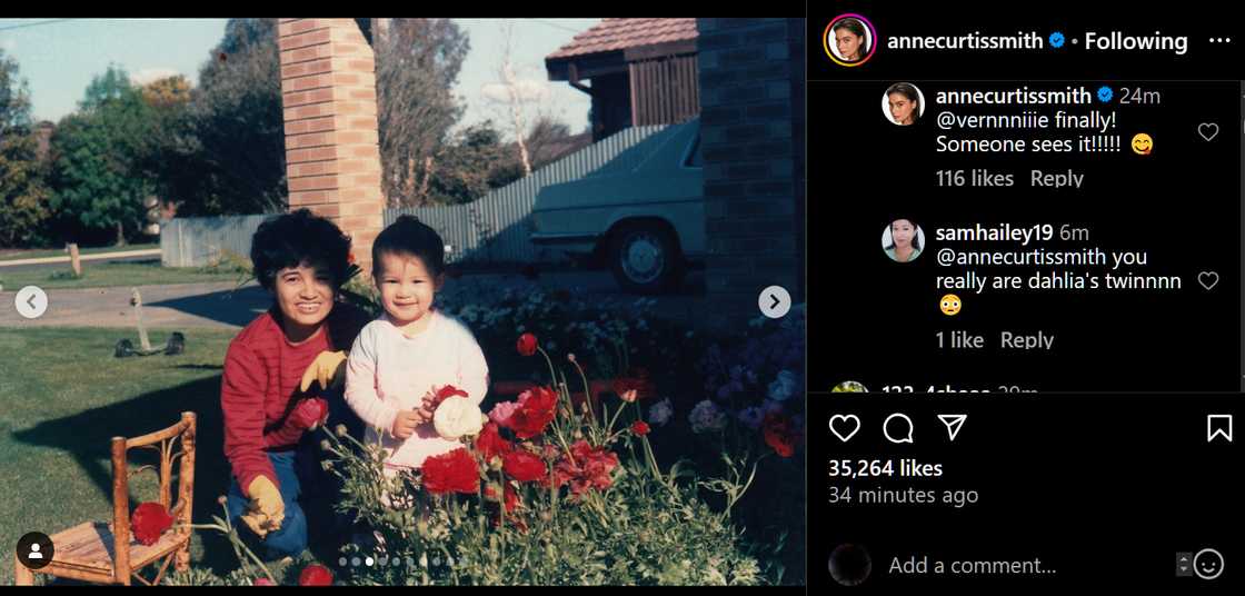 Anne Curtis, tinawag ng ilang netizens na kambal ni Dahlia sa birthday post ng aktres sa kanyang ina