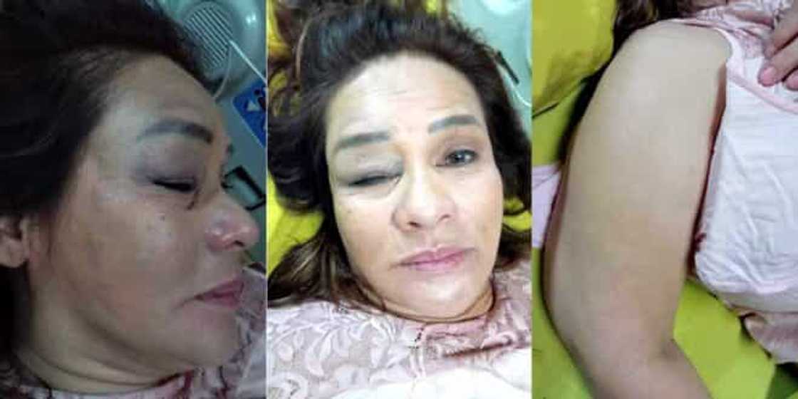 Deborah Sun, naksidente sa taping ng ‘Batang Quiapo’ Deborah Sun, naksidente sa taping ng ‘Batang Quiapo’