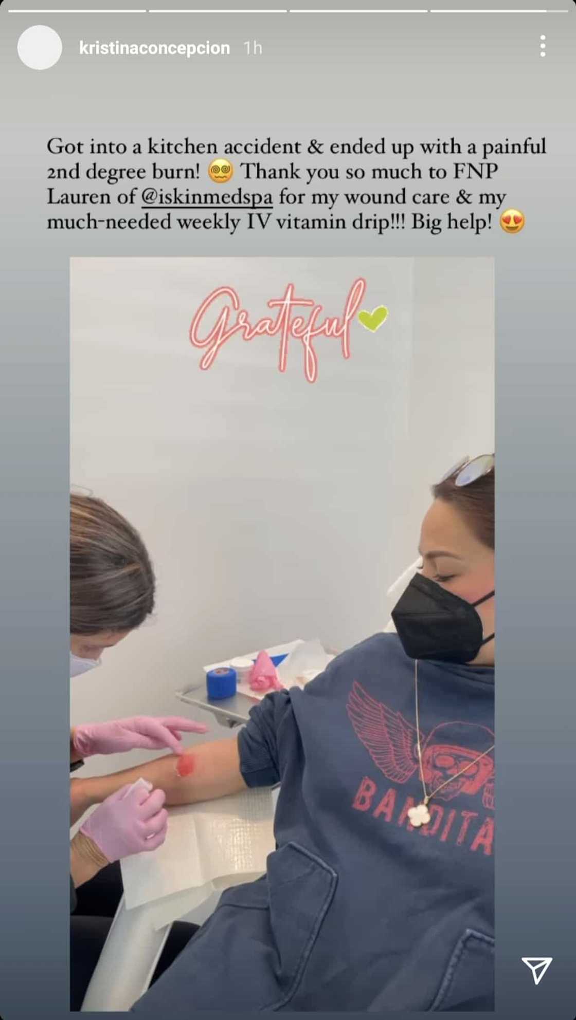 KC Concepcion receives "painful" second-degree burn in recent "kitchen accident" KC Concepcion receives "painful" second-degree burn in recent "kitchen accident"