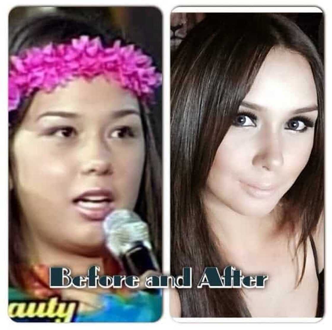 7 Pinoy celebrities who admitted to undergoing cosmetic surgeries to improve their look 7 Pinoy celebrities who admitted to undergoing cosmetic surgeries to improve their look