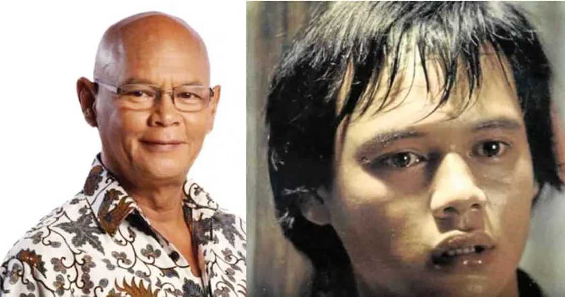 8 Famous bald celebrities when they still had hair 8 Famous bald celebrities when they still had hair