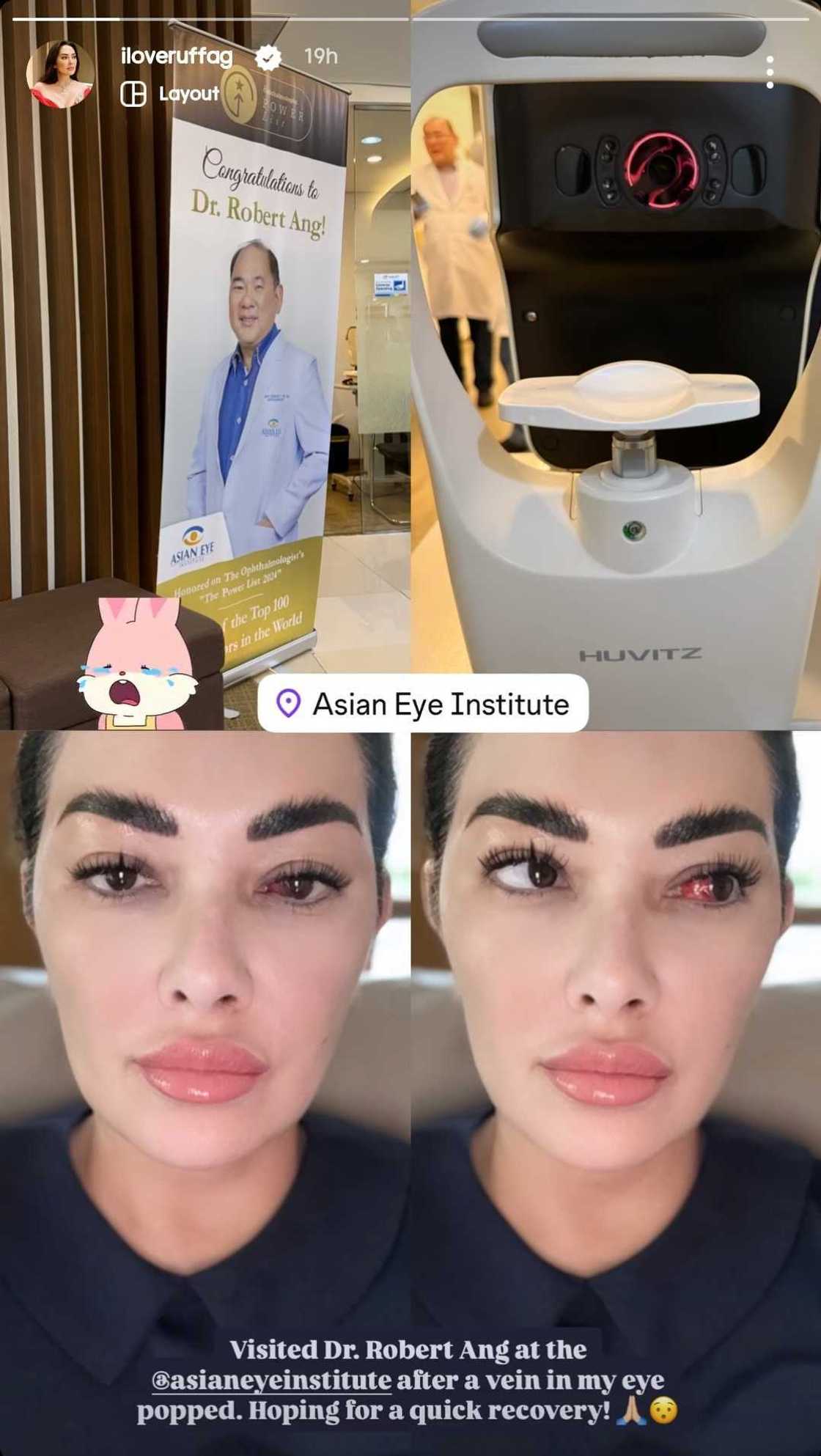 Ruffa Gutierrez, agad na dumiretso sa eye clinic dahil sa nangyari sa kanyang mata Ruffa Gutierrez, agad na dumiretso sa eye clinic dahil sa nangyari sa kanyang mata