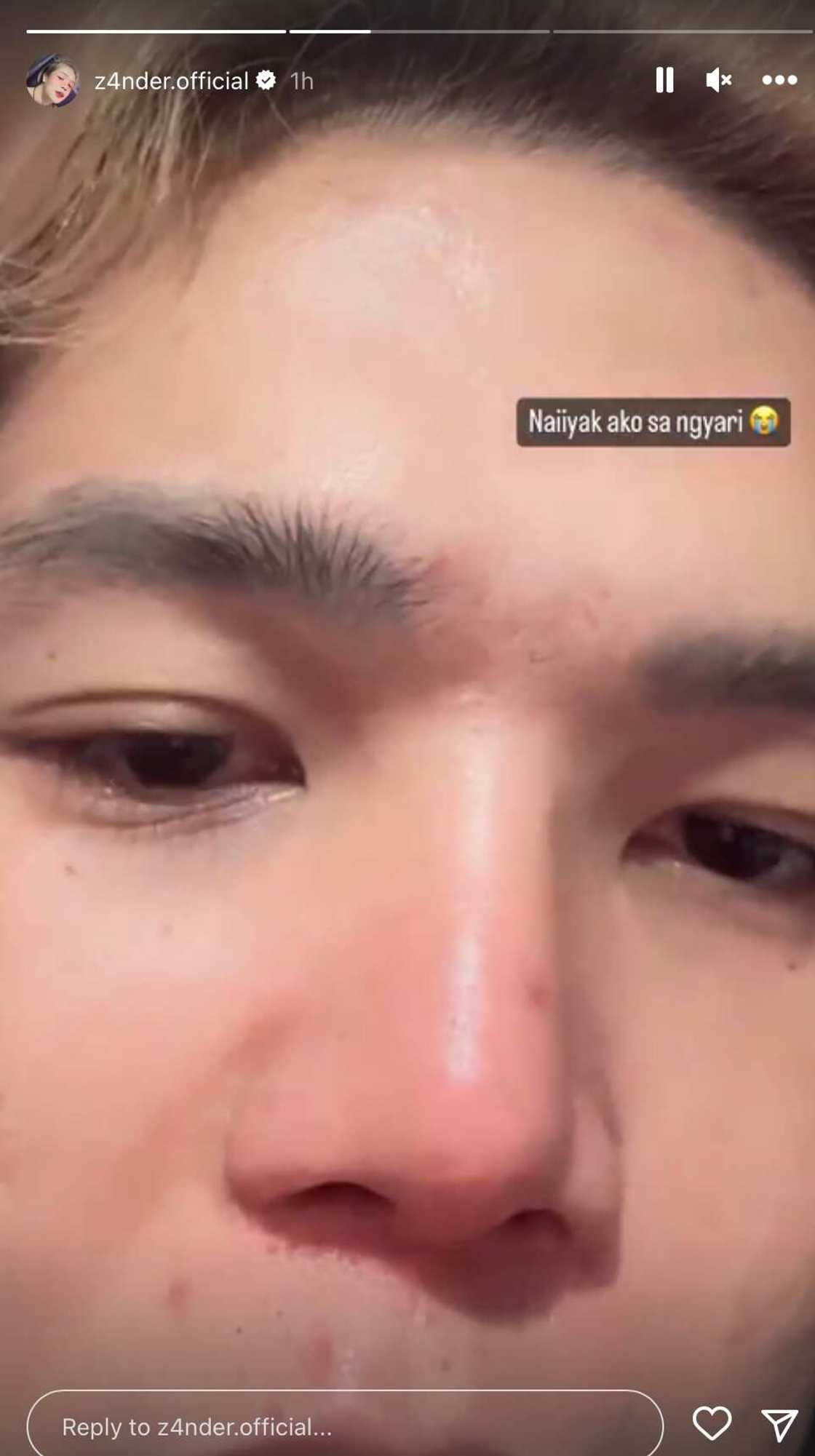 Xander Xander
