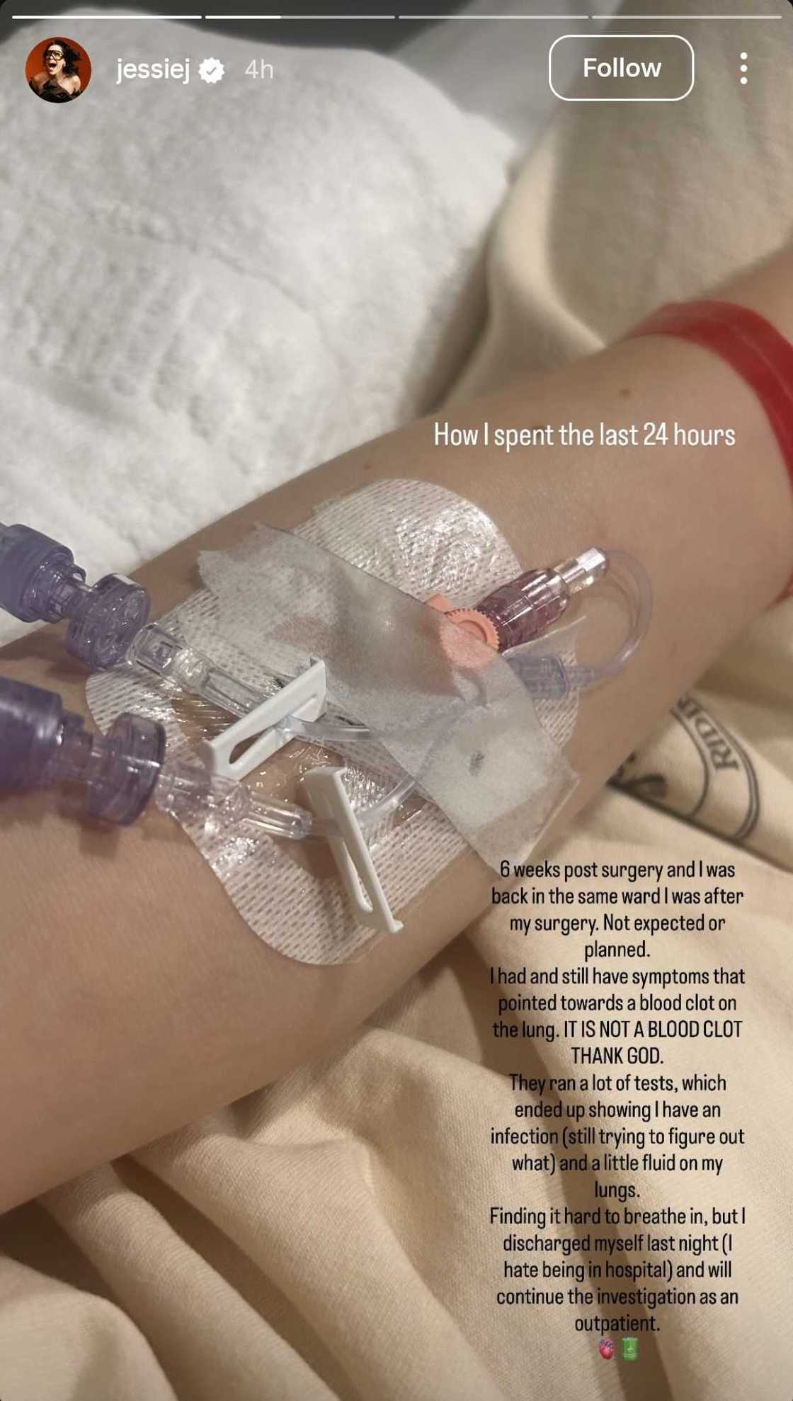 Singer na si Jessie J, muling naospital dahil sa infection at fluid sa kanyang lungs Singer na si Jessie J, muling naospital dahil sa infection at fluid sa kanyang lungs