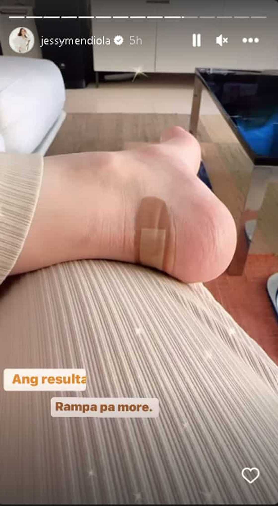 Jessy Mendiola Jessy Mendiola