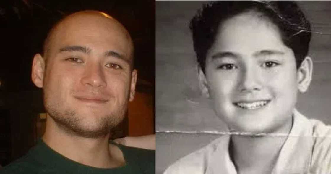 8 Famous bald celebrities when they still had hair 8 Famous bald celebrities when they still had hair