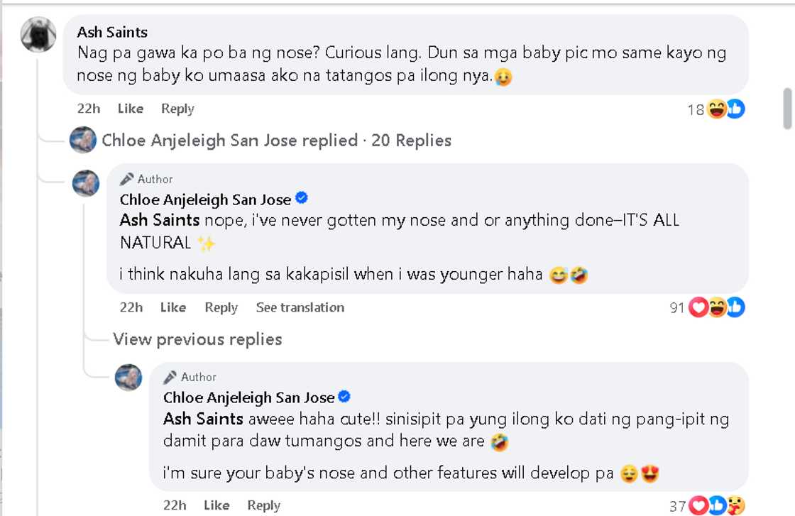 Chloe San Jose, sinagot ang tanong tungkol sa kanyang ilong: “It’s all natural!” Chloe San Jose, sinagot ang tanong tungkol sa kanyang ilong: “It’s all natural!”