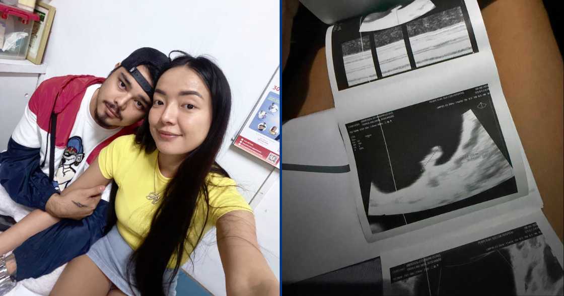 Rosmar Tan, ibinahagi ang pag-asang pinanghawakan bago tuluyang mawala ang kanyang baby