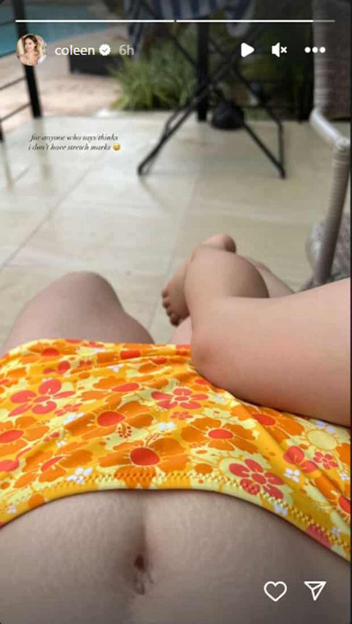 Coleen Garcia Coleen Garcia