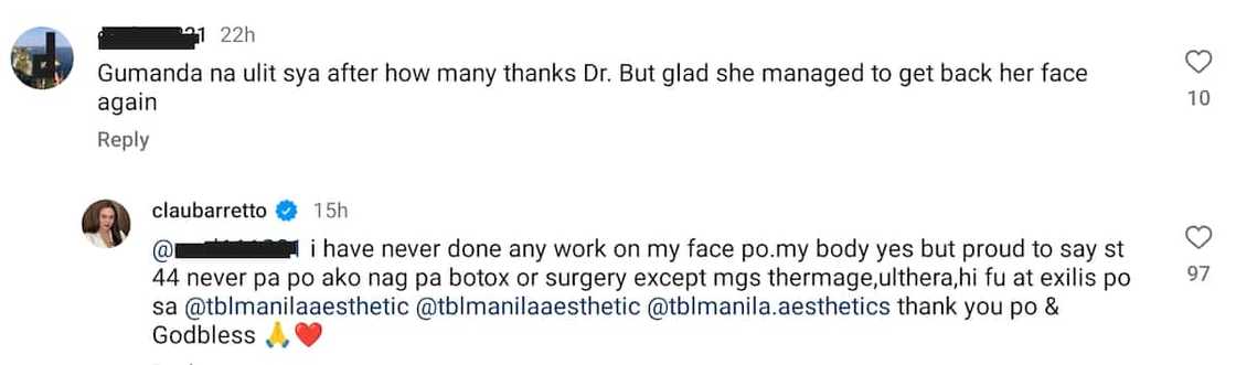 Claudine Barretto, sinagot ang komentong gumanda siya matapos magpaayos ng mukha Claudine Barretto, sinagot ang komentong gumanda siya matapos magpaayos ng mukha