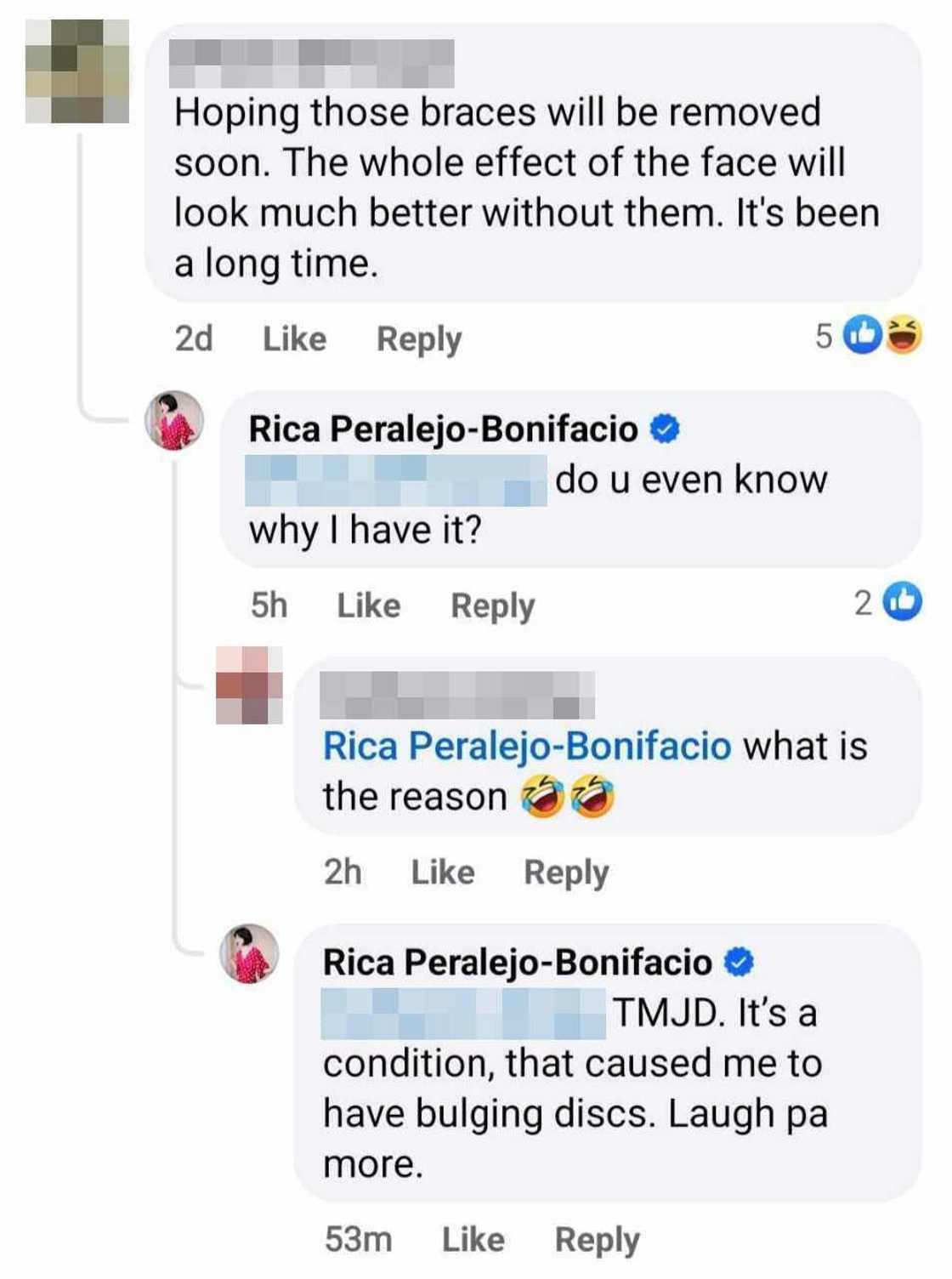 Rica Peralejo sa mga netizens na pumuna ng kanyang braces: "Laugh pa more" Rica Peralejo sa mga netizens na pumuna ng kanyang braces: "Laugh pa more"