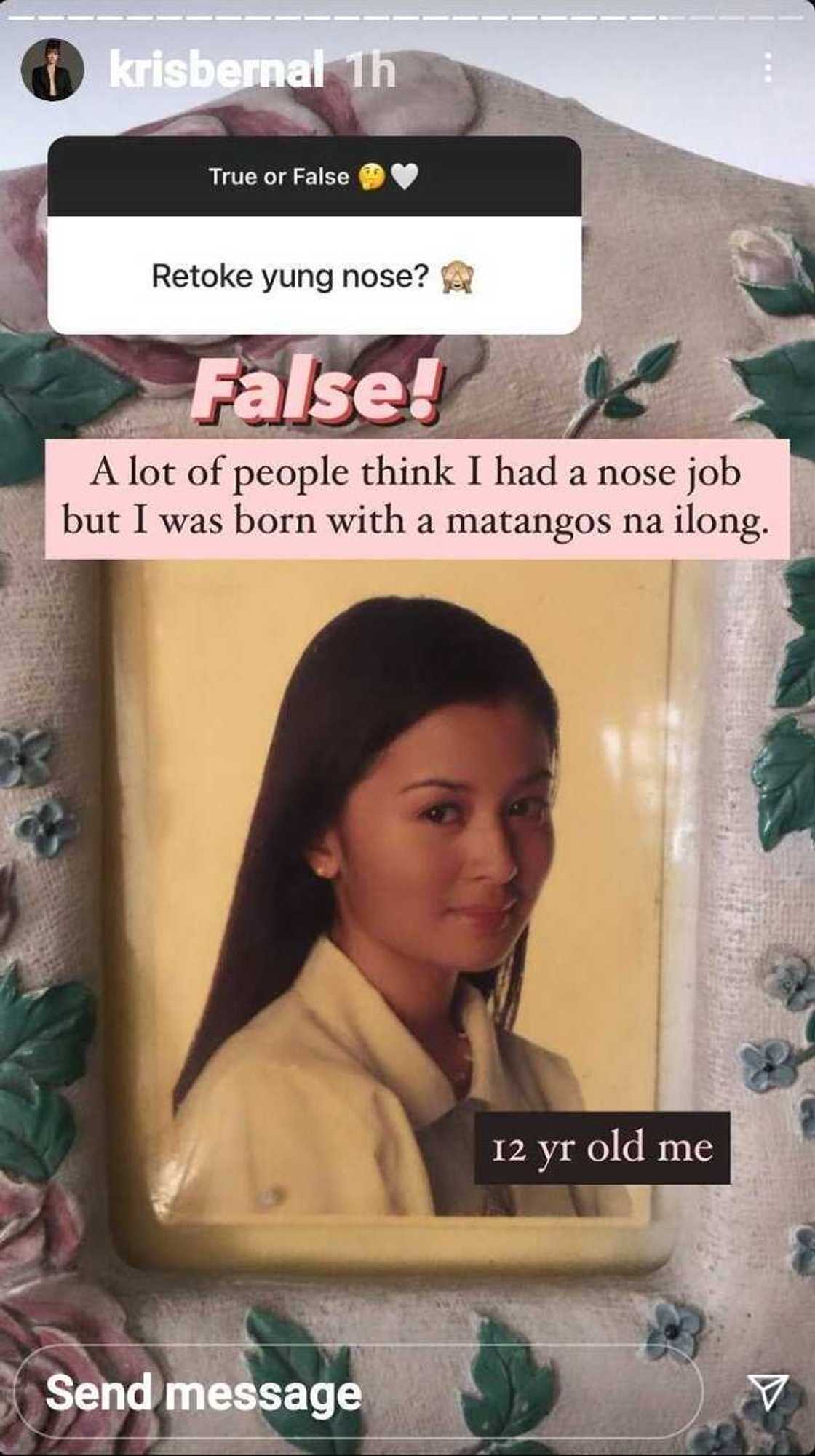 Kris Bernal debunks speculations that she had a nose job Kris Bernal debunks speculations that she had a nose job