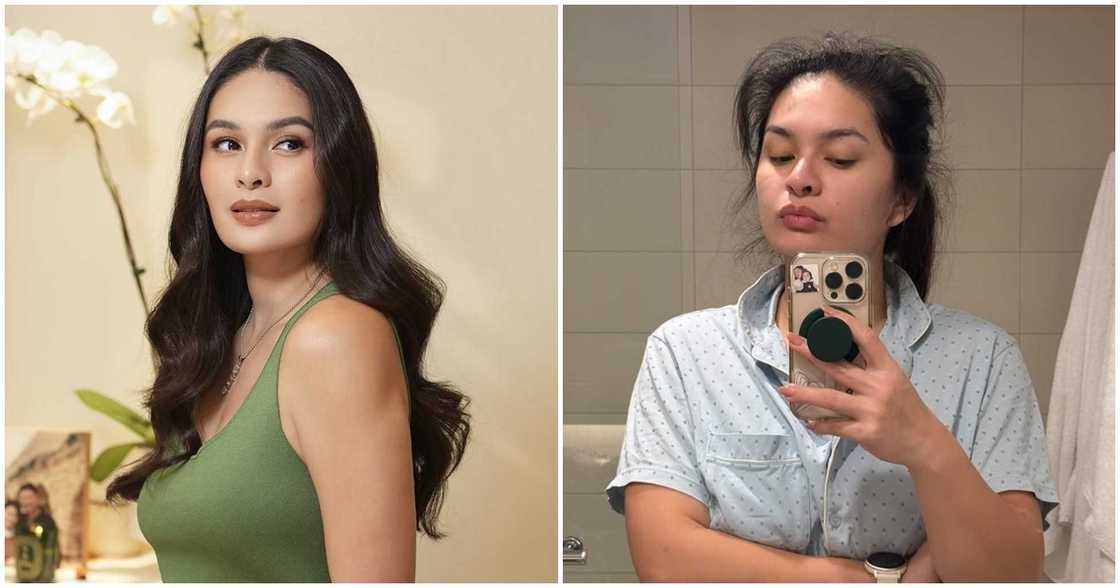 Pauleen Luna candidly shares her postpartum hair struggles in latest selfie post Pauleen Luna candidly shares her postpartum hair struggles in latest selfie post
