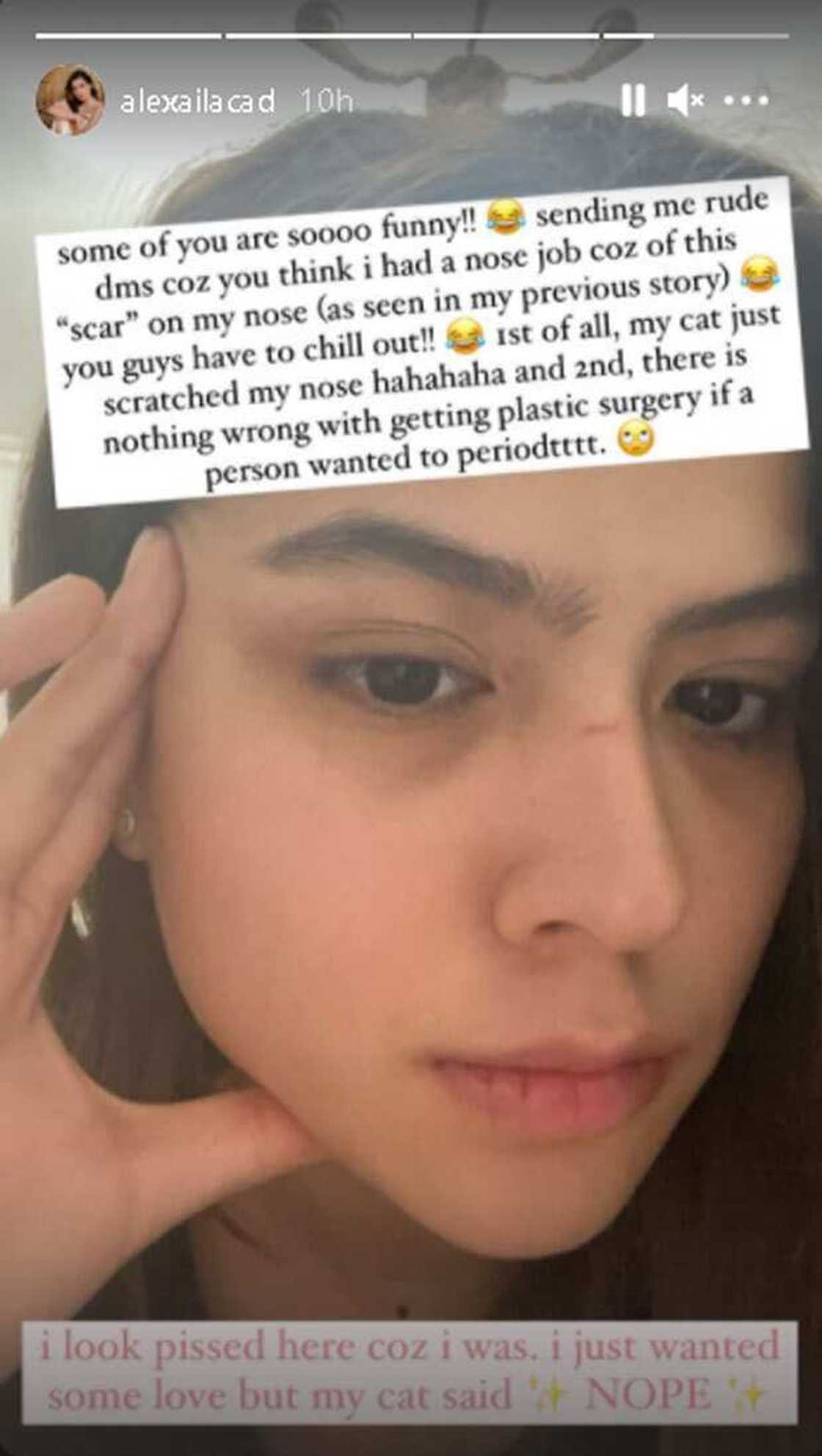 Alexa Ilacad, bongga ang resbak sa rude bashers na inakusahan siyang nagpa nose job Alexa Ilacad, bongga ang resbak sa rude bashers na inakusahan siyang nagpa nose job