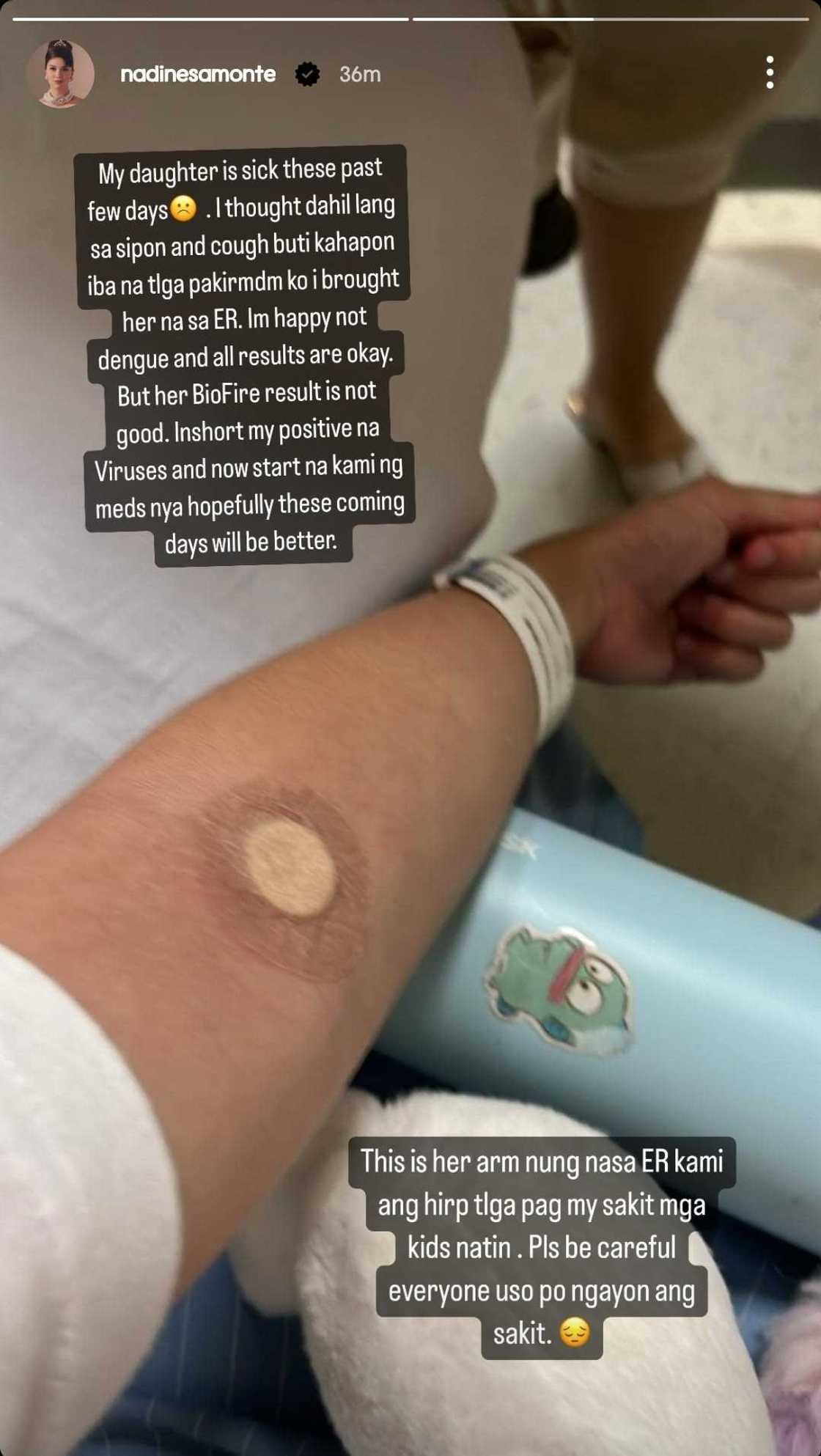 Nadine Samonte, nabahala sa sakit ng kanyang anak: "May positive na viruses" Nadine Samonte, nabahala sa sakit ng kanyang anak: "May positive na viruses"