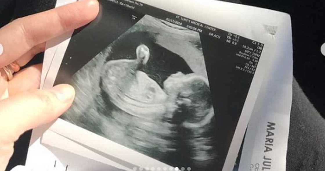 Ellen Adarna shares her treasured pregnancy photo and sonogram of Baby Elias Ellen Adarna shares her treasured pregnancy photo and sonogram of Baby Elias