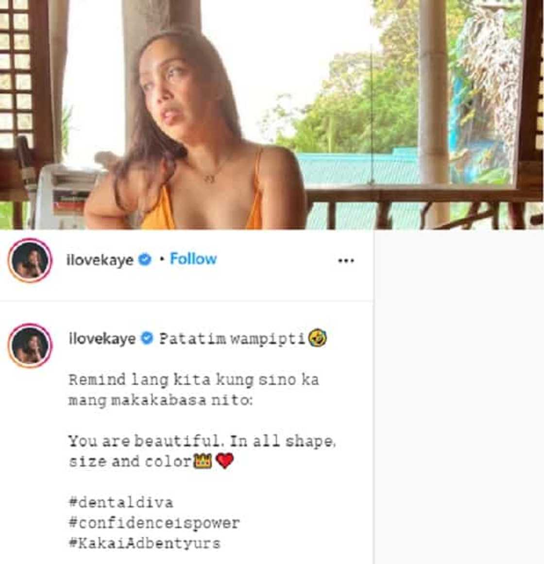 Kakai Bautista reminds public about beauty amid conflict with Mario Maurer’s agency Kakai Bautista reminds public about beauty amid conflict with Mario Maurer’s agency