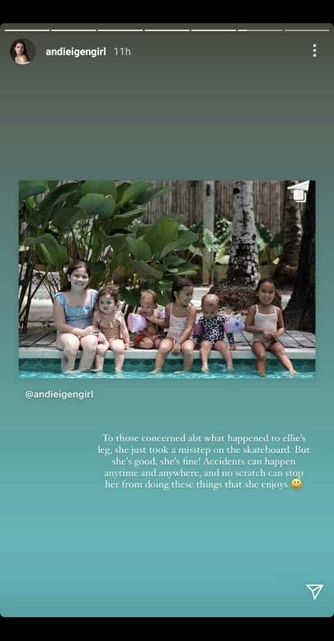 Andi Eigenmann, nagpaliwanag kung bakit nagkasugat si Ellie Eigenmann sa binti Andi Eigenmann, nagpaliwanag kung bakit nagkasugat si Ellie Eigenmann sa binti