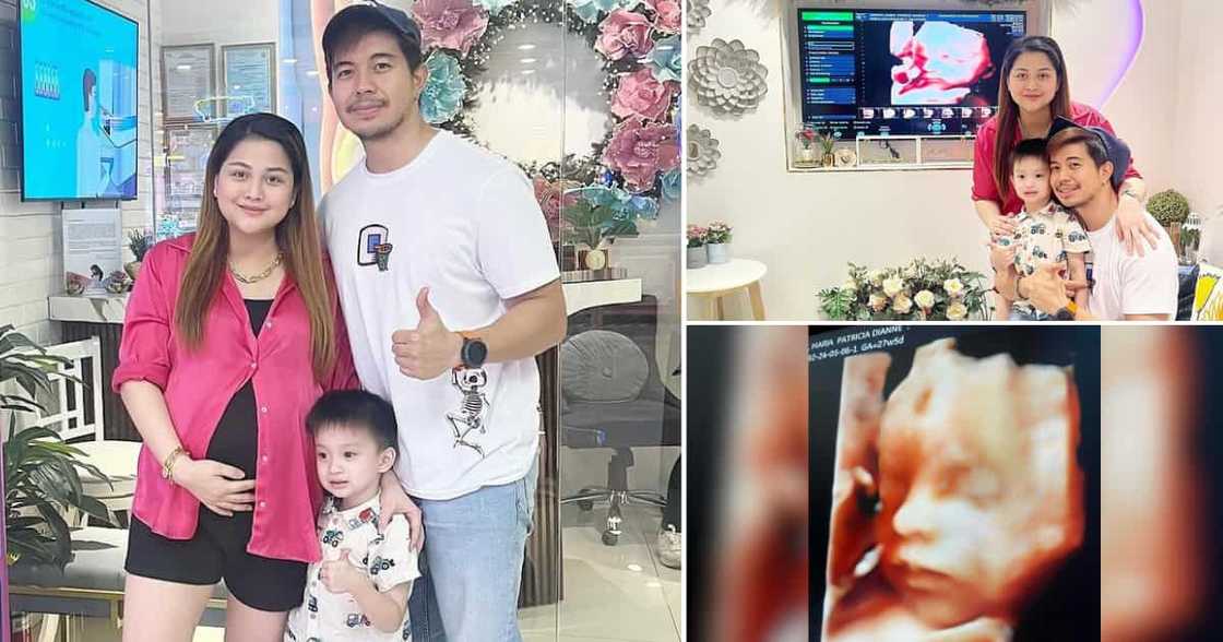 Rodjun Cruz shares sonogram of his, Dianne Medina’s 2nd baby Rodjun Cruz shares sonogram of his, Dianne Medina’s 2nd baby