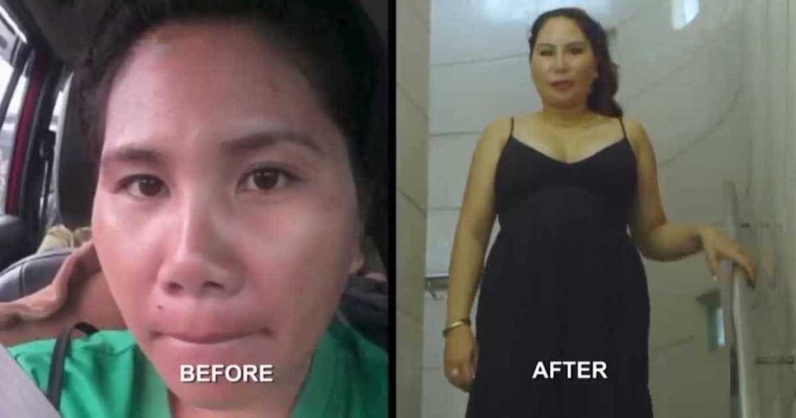 Pinay, gumasta ng P1.3M para gumanda: “Kung ano yung pinabago ko sa sarili ko, kuntento na ako” Pinay, gumasta ng P1.3M para gumanda: “Kung ano yung pinabago ko sa sarili ko, kuntento na ako”