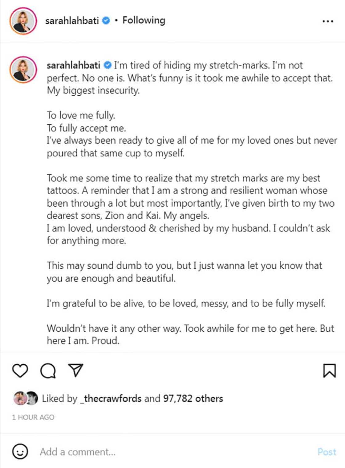 Sarah Lahbati, pagod na sa kakatago sa kanyang stretch marks; sinabing di siya perfect: “No one is” Sarah Lahbati, pagod na sa kakatago sa kanyang stretch marks; sinabing di siya perfect: “No one is”