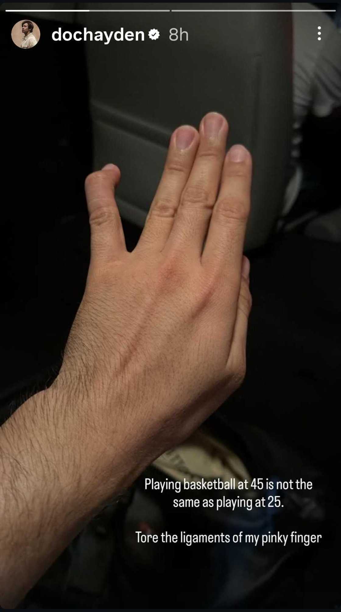 Hayden Kho, nagtamo ng injury matapos maglaro ng basketball (Photo: @dochayden) Hayden Kho, nagtamo ng injury matapos maglaro ng basketball (Photo: @dochayden)