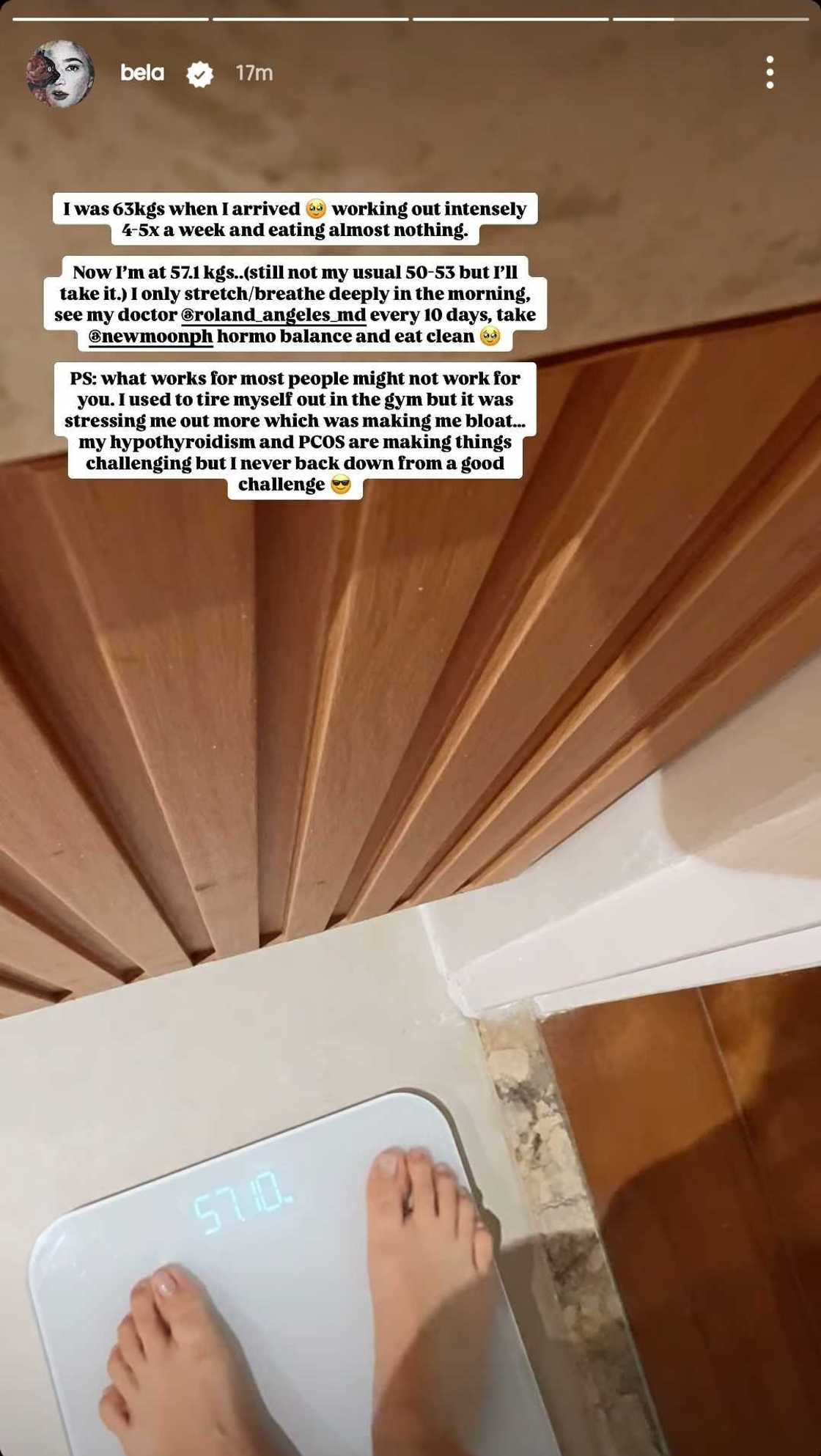 Bela Padilla, nagkuwento tungkol sa pagkakaroon ng PCOS at hypothyroidism Bela Padilla, nagkuwento tungkol sa pagkakaroon ng PCOS at hypothyroidism