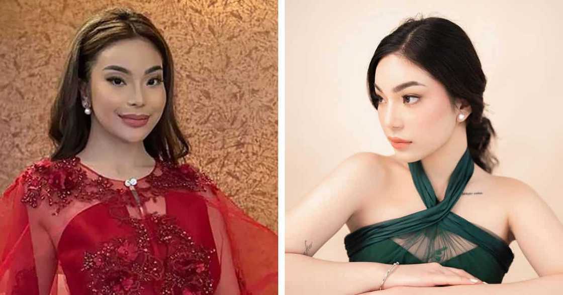 Kitty Duterte reveals getting cosmetic surgery: “Got a rhinoplasty. I've been so happy with my nose” Kitty Duterte reveals getting cosmetic surgery: “Got a rhinoplasty. I've been so happy with my nose”