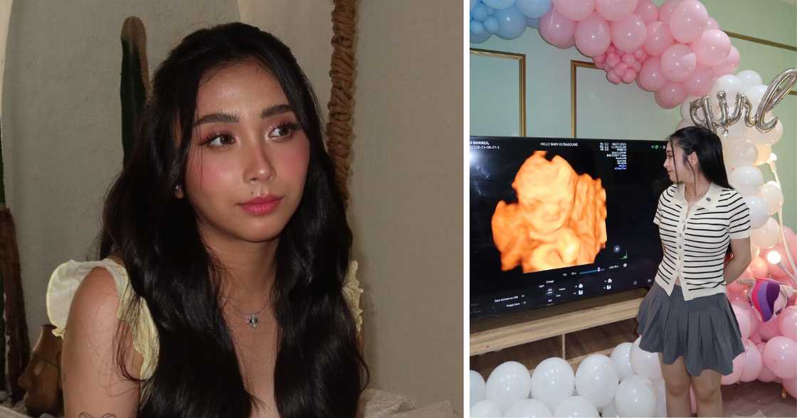 Bea Borres shows off her baby’s developing features in new sonogram Bea Borres shows off her baby’s developing features in new sonogram