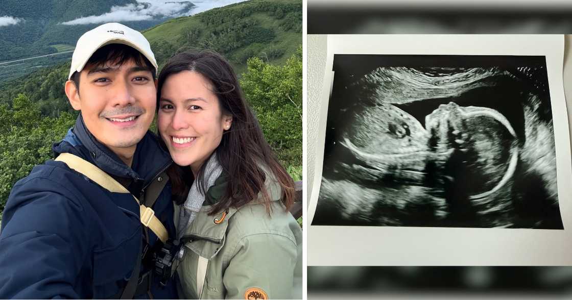 Robi Domingo, ibinahagi ang sonogram ng baby nila ni Maiqui Pineda