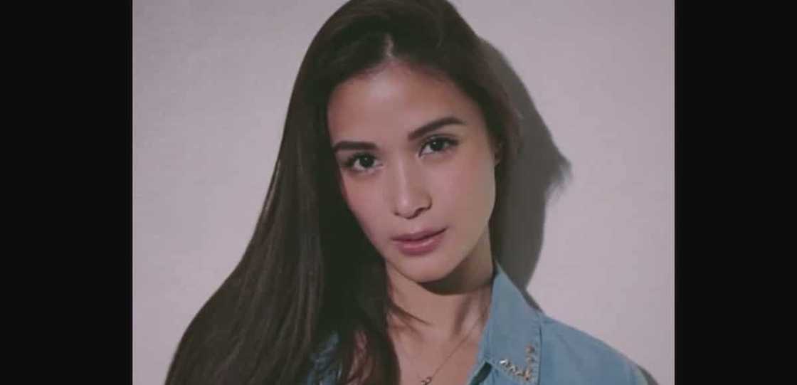 Heart Evangelista denies undergoing plastic surgeries on her face Heart Evangelista denies undergoing plastic surgeries on her face