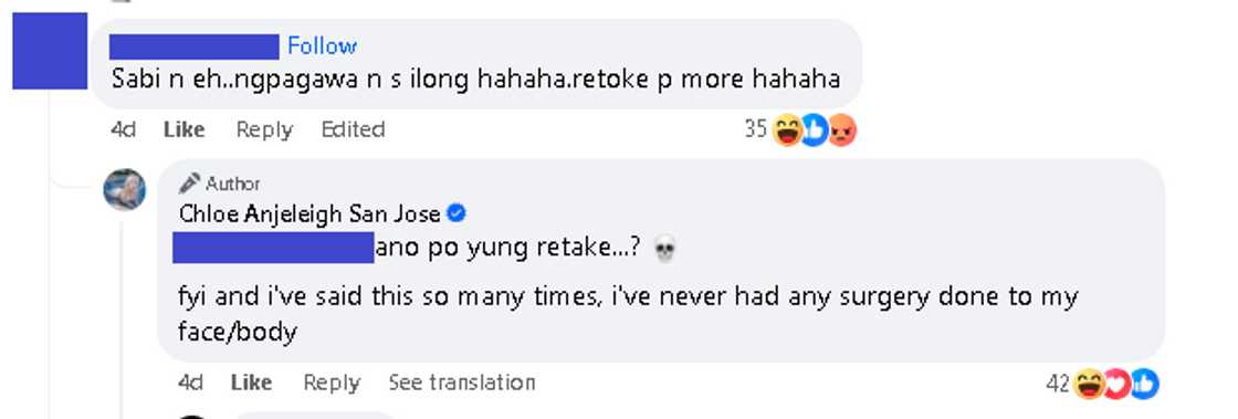 Chloe San Jose, sinagot ang netizen na nagsabing nagpa-retoke siya Chloe San Jose, sinagot ang netizen na nagsabing nagpa-retoke siya