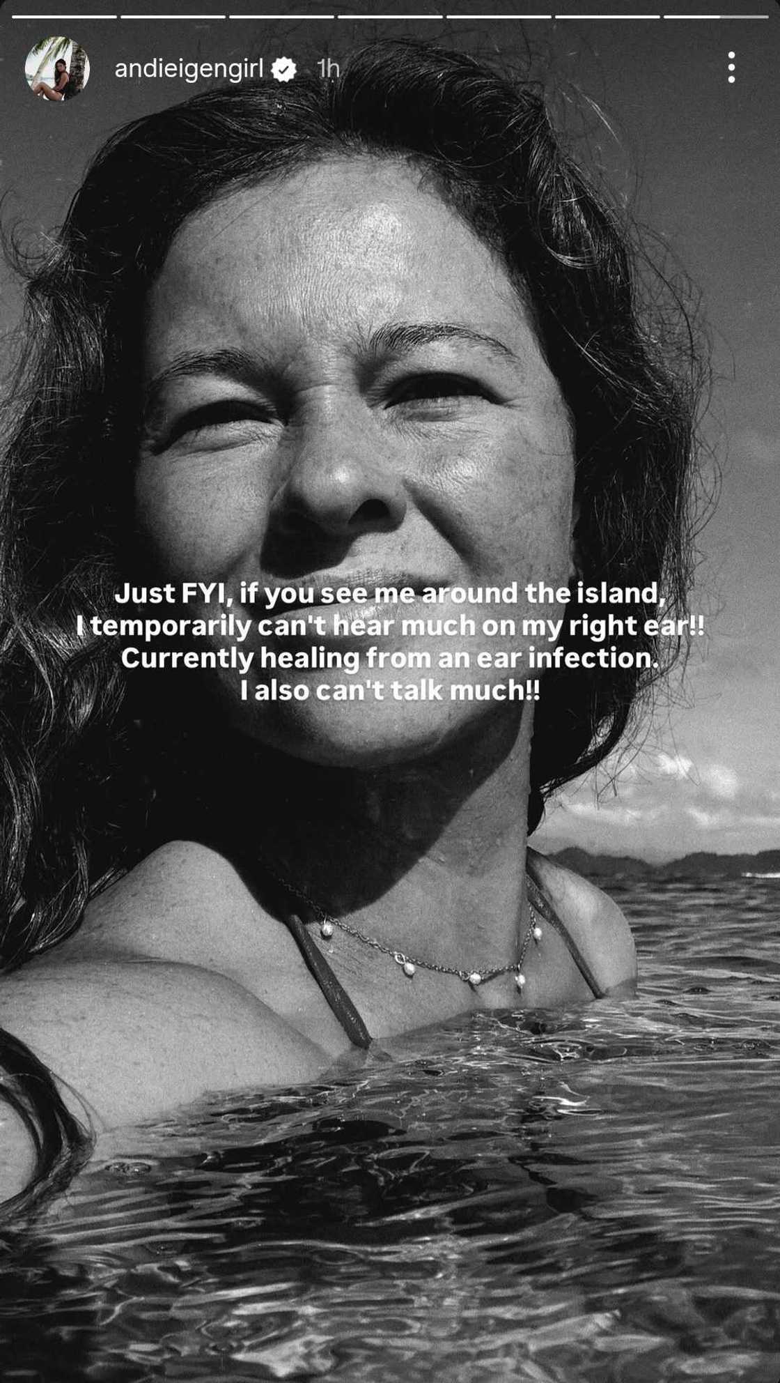 Andi Eigenmann, may 'FYI' note at health update matapos maapektuhan ang pandinig Andi Eigenmann, may 'FYI' note at health update matapos maapektuhan ang pandinig