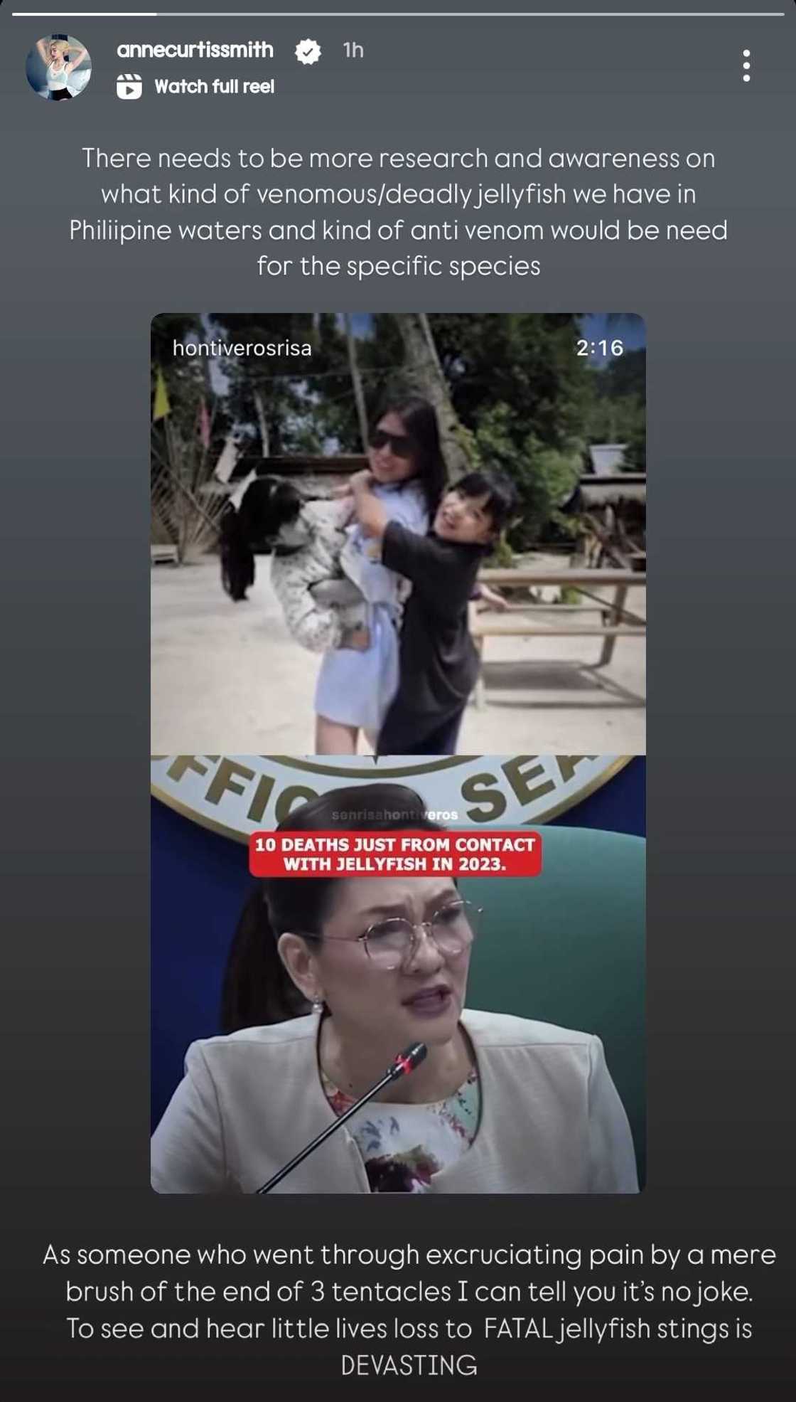 Anne Curtis backs Sen. Risa Hontiveros' 'Sandy's Act' for further awareness Anne Curtis backs Sen. Risa Hontiveros' 'Sandy's Act' for further awareness