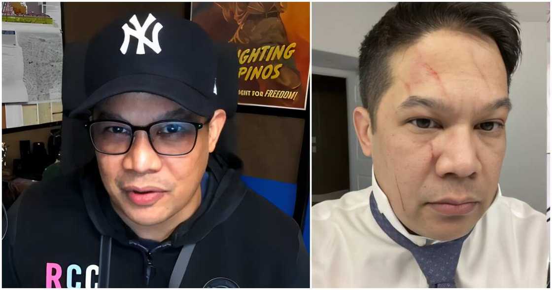 Mo Twister, ipinakita ang mga kalmot sa mukha sa gitna ng hiwalayan nila ni Angelicopter Mo Twister, ipinakita ang mga kalmot sa mukha sa gitna ng hiwalayan nila ni Angelicopter