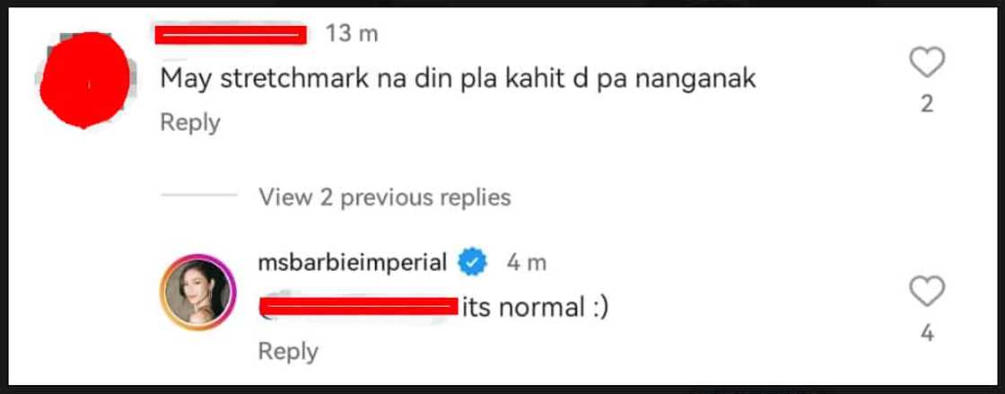 Barbie Imperial sa netizen na nagkomento tungkol sa kanyagn stretchmarks: "It's normal"