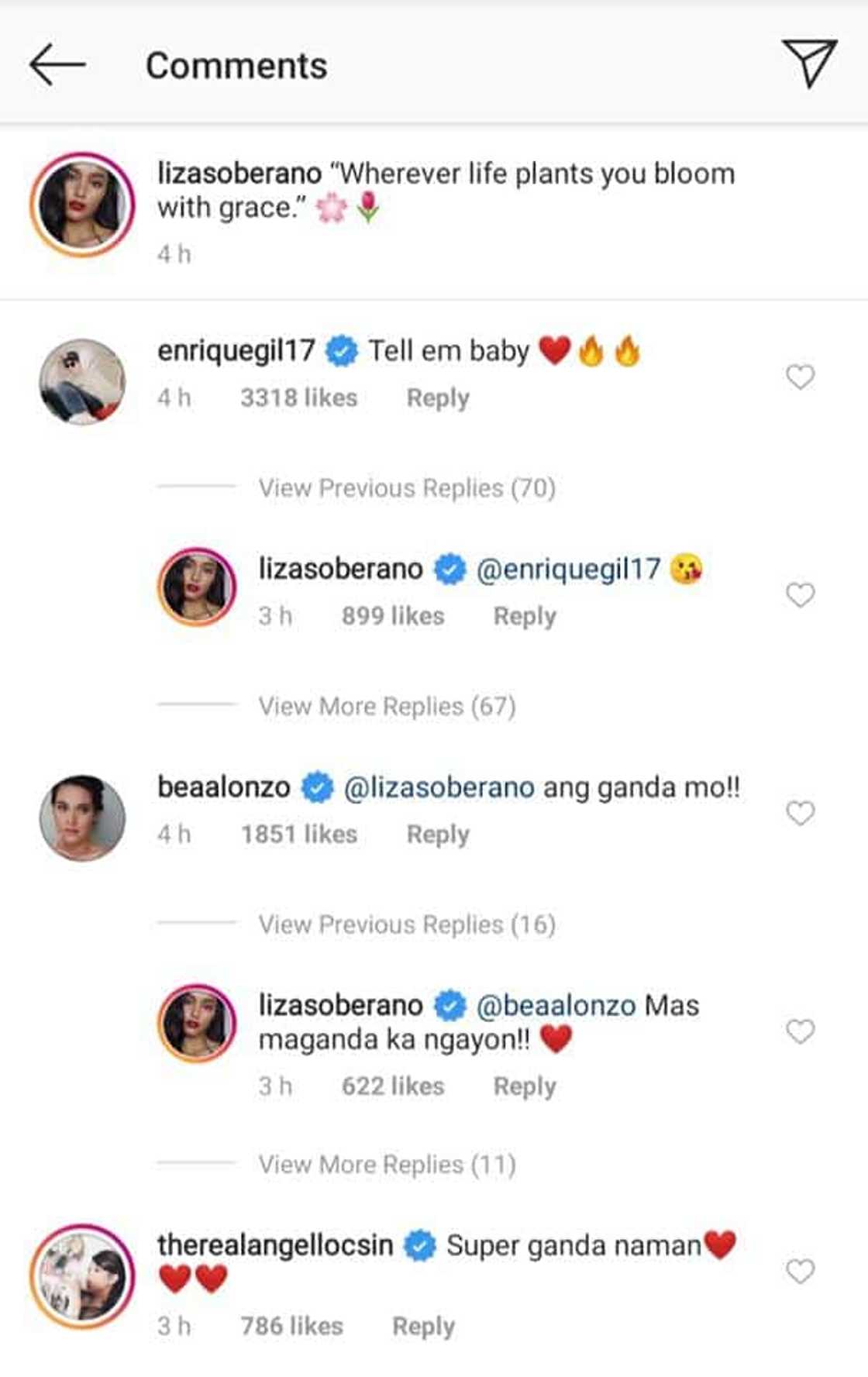 Bea Alonzo, Angelica Panganiban, other celebs react to Liza Soberano's viral photo