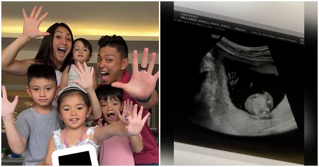 Iya Villania at Drew Arellano, magkakaroon muli ng bagong baby Iya Villania at Drew Arellano, magkakaroon muli ng bagong baby