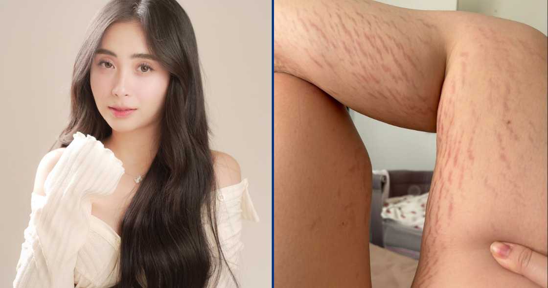 Bea Borres, nagbahagi ng totoong pakikibaka sa post-pregnancy body niya