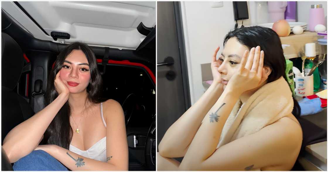 Camille Trinidad, binahagi ang kanyang rhinoplasty journey sa kanilang bagong vlog