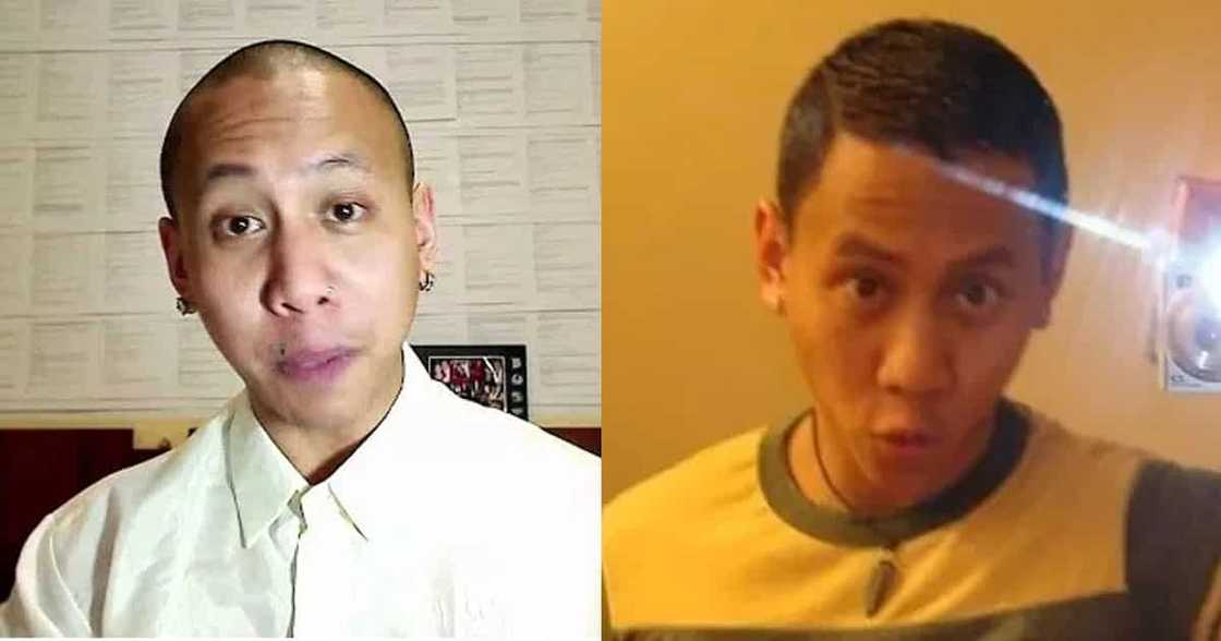 8 Famous bald celebrities when they still had hair 8 Famous bald celebrities when they still had hair