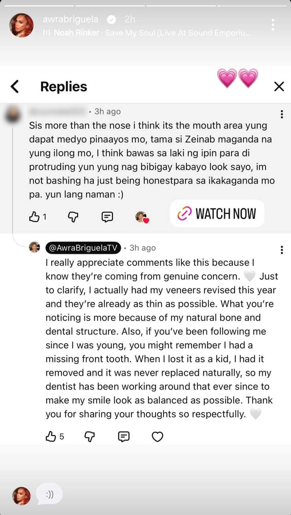 Reaksyon ni Awra Briguela sa payo ng isang netizen sa kanyang itsura, viral