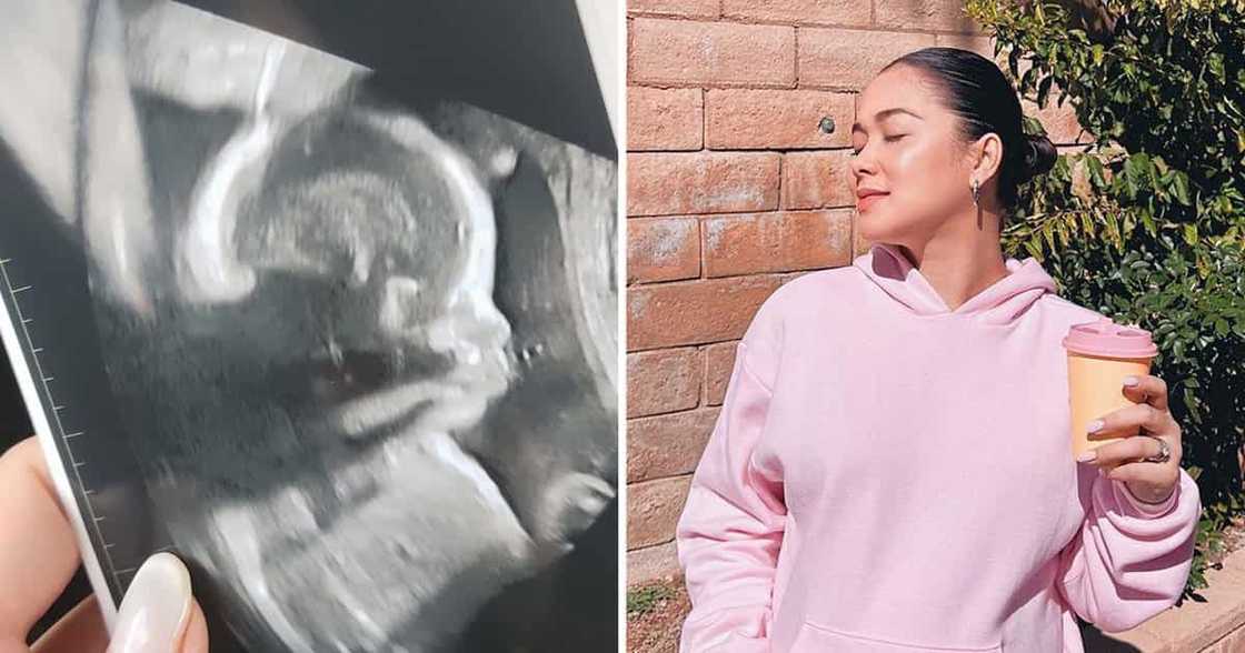 Maja Salvador, excited nang makita unang baby nila ni Rambo Nuñez: “Can’t wait!” Maja Salvador, excited nang makita unang baby nila ni Rambo Nuñez: “Can’t wait!”